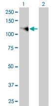 Monoclonal Mouse anti-Human FGFR1 / FGF Receptor 1 Antibody (clone 5E9, WB)