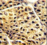 AADAC Antibody (aa273-300)
