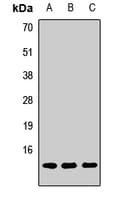 Polyclonal Rabbit anti-Human POLR2J Antibody (IF, WB)