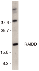 Polyclonal Rabbit anti-Human CRADD / RAIDD Antibody (aa181-199, IHC, WB)