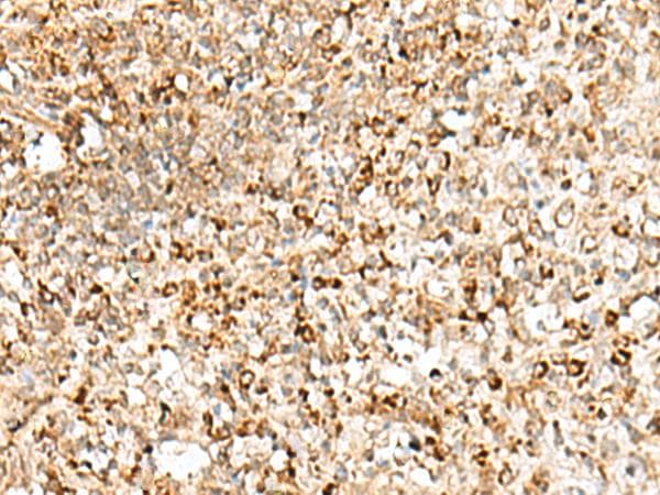 TEX11 Antibody