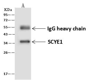 AIMP1 / EMAP II Antibody (Preservative Free)