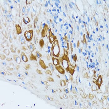 Polyclonal Rabbit anti-Human PSRC1 / DDA3 Antibody (IHC, WB)
