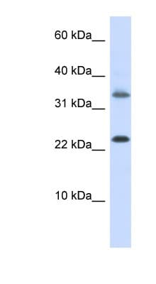 Polyclonal Rabbit anti-Human EMX1 Antibody (aa180-229, WB)