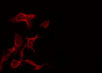 EGFR Antibody (phospho-Ser695)