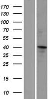 Human ZNF830 / CCDC16 Protein (Over-Expression Lysate Myc-DDK (Flag))