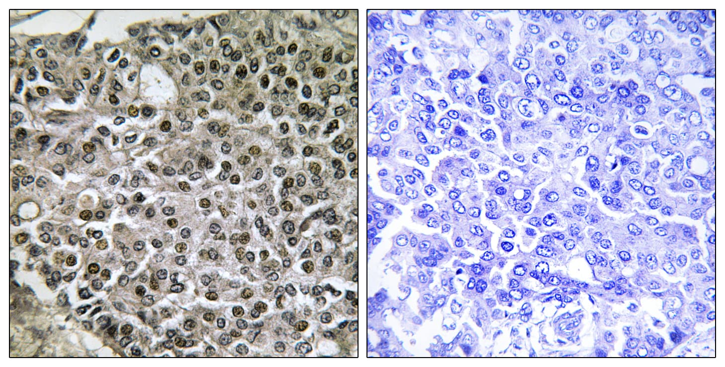 NFATC4 / NFAT3 Antibody (aa642-691)