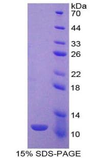 Rat IDO1 / IDO Protein (Recombinant His)