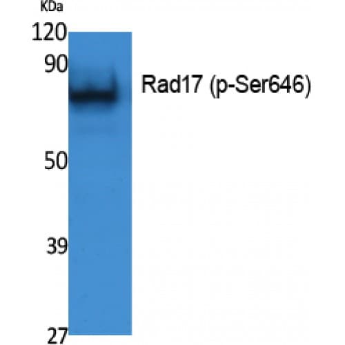 Polyclonal Rabbit anti-Human RAD17 Antibody (580-660 aa, WB)