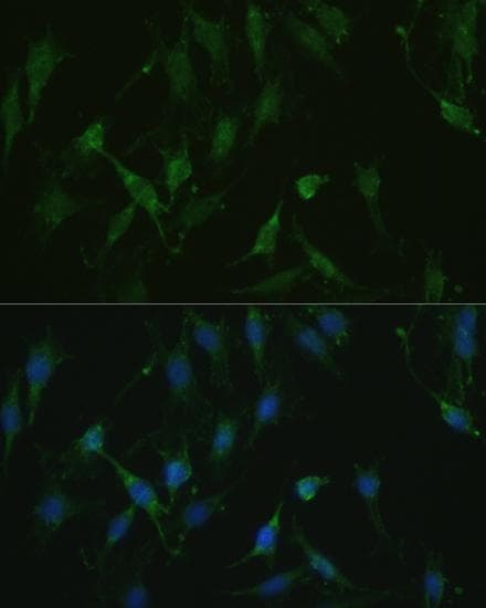 VR1 / TRPV1 Antibody