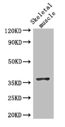 DNAJB6 Antibody