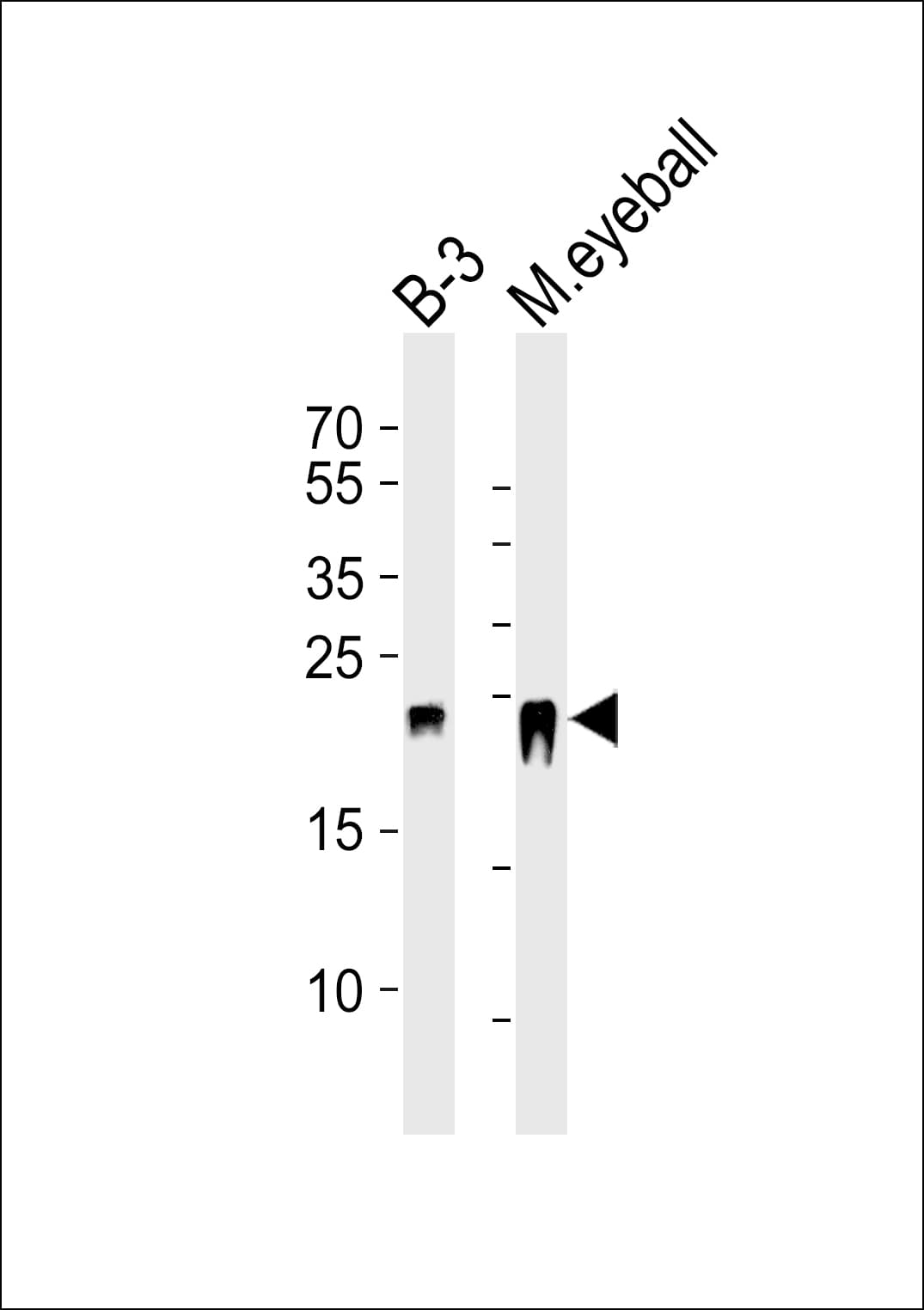 CRYBB2 Antibody (aa4-36)