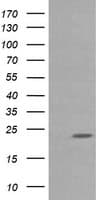 Monoclonal Mouse anti-Human RAB30 Antibody (clone OTI3F4, IF, WB)