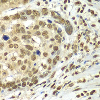 Polyclonal Rabbit anti-Human HDAC2 Antibody (IHC, IF, WB)