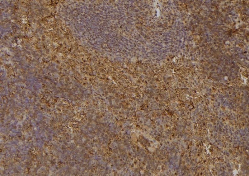 Polyclonal Rabbit anti-Human CDKN3 / KAP Antibody (IHC, IF, WB)