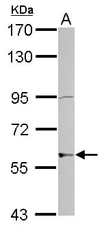 Polyclonal Rabbit anti-Human ZNF596 Antibody (WB)