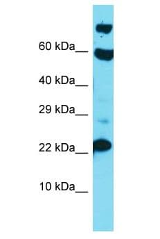 VSTM5 Antibody (aa147-196)
