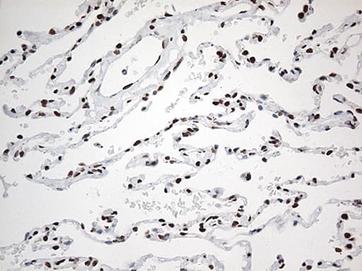 Monoclonal Mouse anti-Human EWSR1 / EWS Antibody (clone OTI3F6, aa256-447, IHC, IF, WB)
