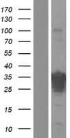 R3HCC1 Protein (Over-Expression Lysate Myc-DDK (Flag))