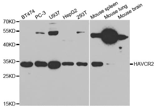Polyclonal Rabbit anti-Human HAVCR2 / TIM-3 Antibody (aa22-202, IHC, WB)