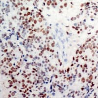 Polyclonal Rabbit anti-Human JUN / c-Jun Antibody (phospho-Ser63, IHC, WB)