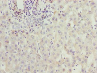 ZNF785 Antibody