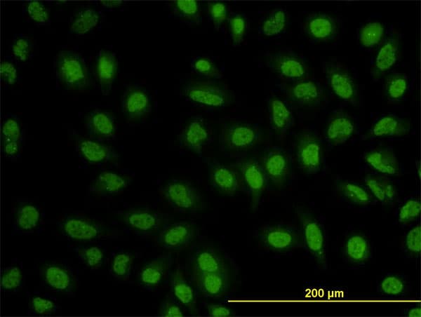 Monoclonal Mouse anti-Human BCL9 Antibody (clone 2D4, IF, WB)