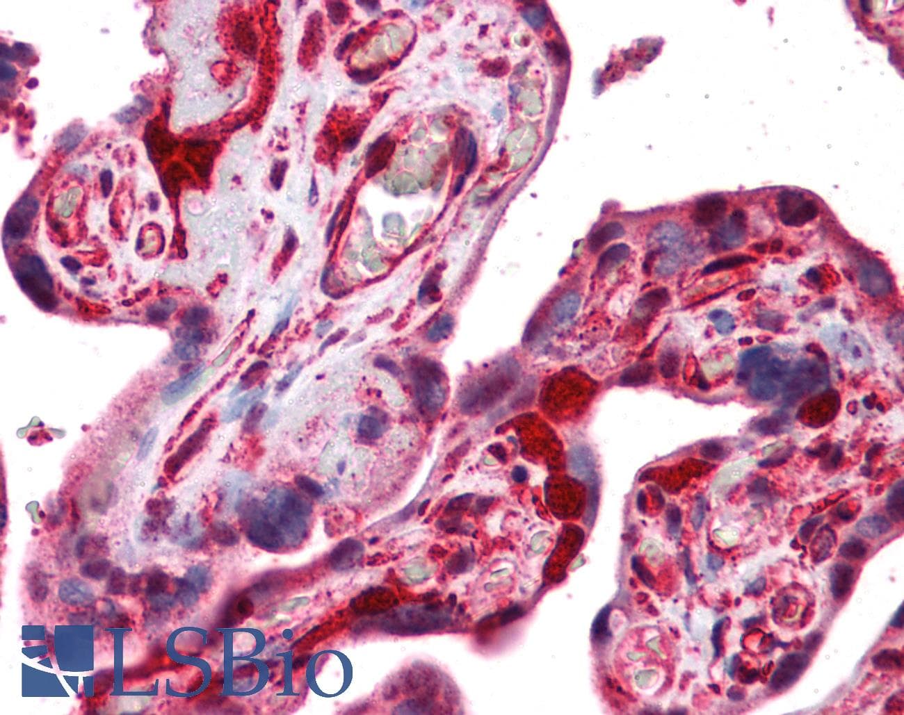 PathPlus™ STMN1 / Stathmin / LAG Antibody