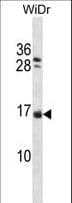 NHLH1 / HEN1 Antibody (aa38-67)