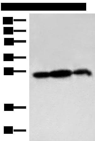 Polyclonal Rabbit anti-Human PDAP1 Antibody (IHC, WB)