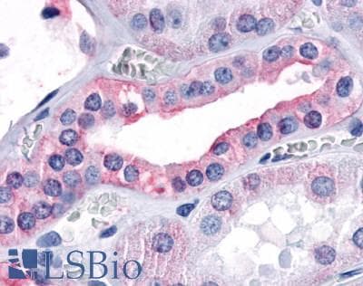 PathPlus™ Polyclonal Rabbit anti-Human GPR80 / GPR99 / OXGR1 Antibody (Extracellular Domain, IHC)
