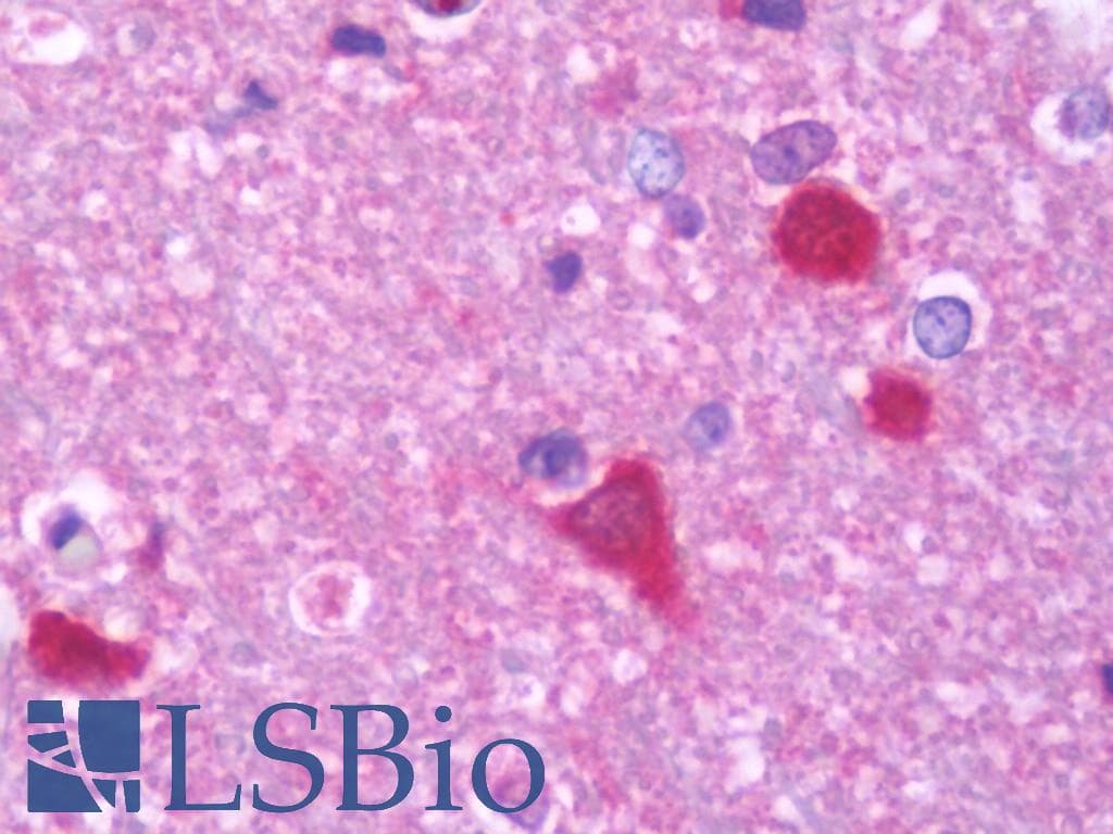 IHC-plus™ Polyclonal Rabbit anti-Human PPP3CB Antibody (aa1-228, IHC, WB)