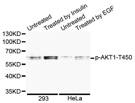 AKT1 Antibody (phospho-Thr450)