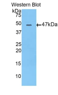 APOB / Apolipoprotein B Antibody (aa331-511)