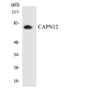 Polyclonal Rabbit anti-Human CAPN12 / Calpain 12 Antibody (aa208-257, WB)