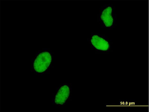 UHRF1 Antibody (clone 3A11)