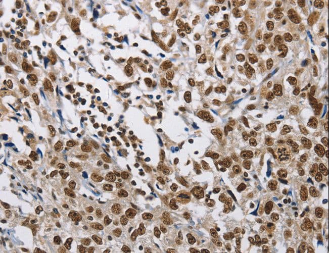 CMTM2 Antibody