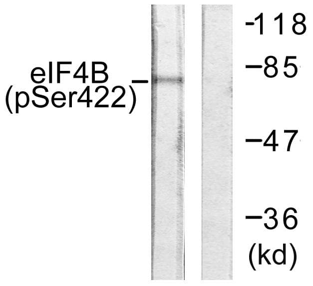 EIF4B Antibody (phospho-Ser422)