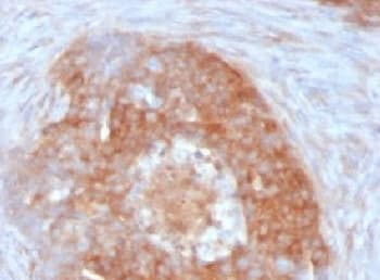 FSCN1 / Fascin Antibody (clone FSCN1/417)