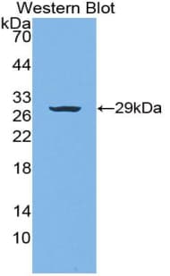 VWA1 / WARP Antibody (aa135-366)