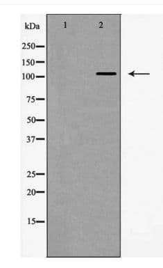 ITGA5/Integrin Alpha 5/CD49e Antibody