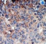 Polyclonal Rabbit anti-Human NME1 / NM23 Antibody (aa25-54, IHC, IF, WB)