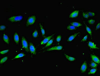 Polyclonal Rabbit anti-Human MOCS2 Antibody (IHC, IF, WB)