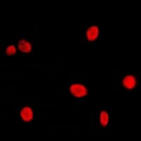 NCBP2 / CBP20 Antibody (N-Terminus)