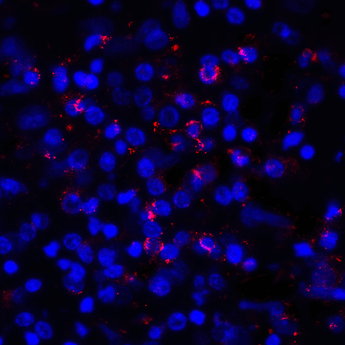 CD274 / B7-H1 / PD-L1 Antibody (clone 8E12)