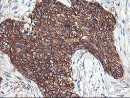 PFKP Antibody (clone OTI2E10)
