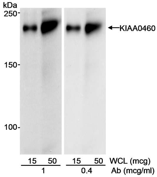 RPRD2 Antibody (aa1000-1050)