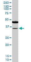 Monoclonal Mouse anti-Human SORD / Sorbitol Dehydrogenase Antibody (clone 4D3, IHC, WB)