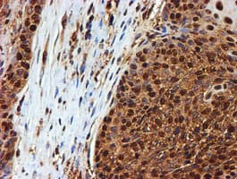PSMB9 Antibody (clone OTI2B6)