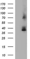 SCAMP2 Antibody (clone OTI3C2)
